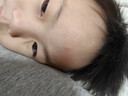 mederma美德玛儿童专用祛 疤膏20g 温和淡疤痕修护凝胶 德国进口 实拍图