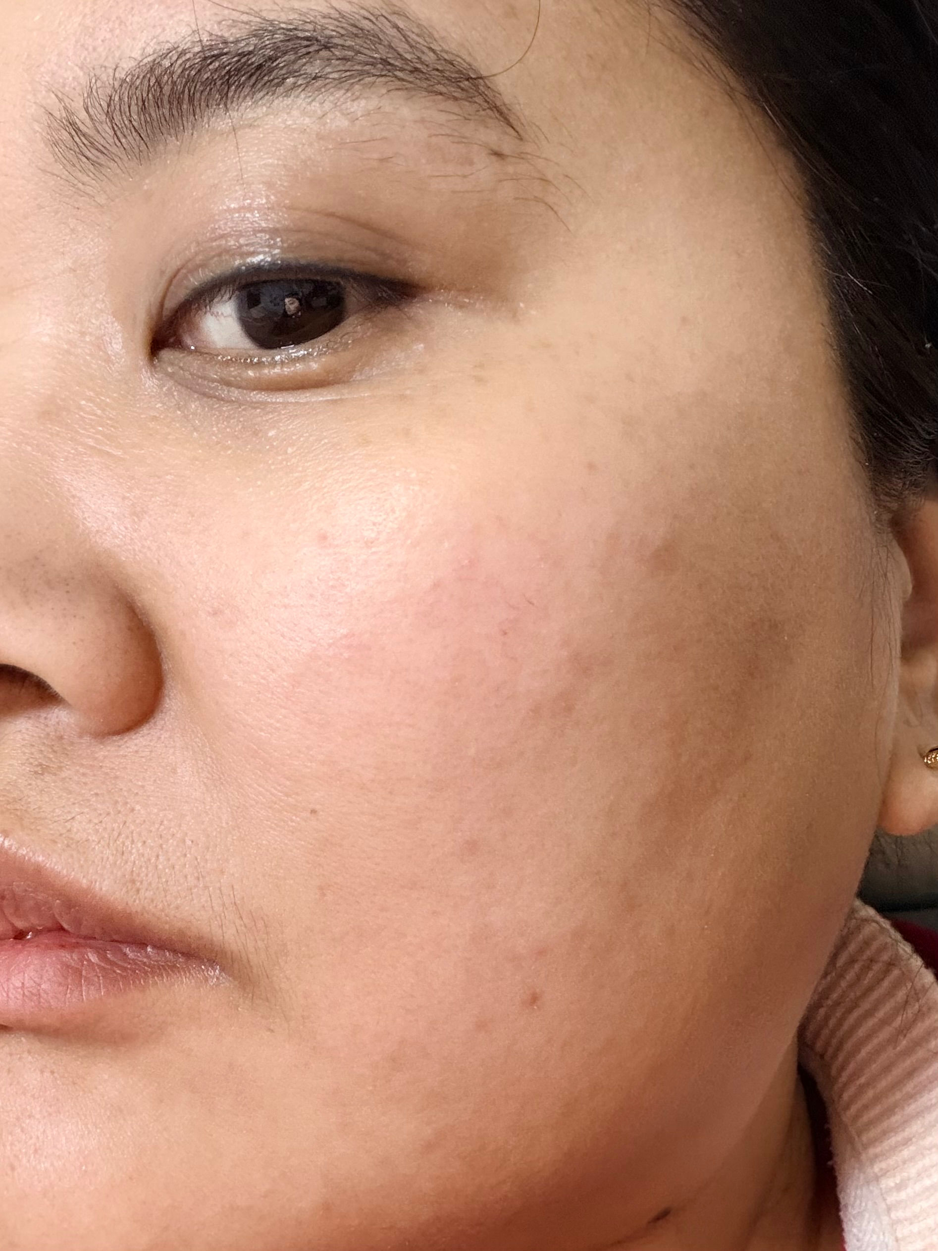 FcMzit复美滋水晶白番茄胶囊烟酰胺焕白透亮*3+麦角硫因PQQ时光抗皱瓶*3 实拍图