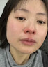 御医匠鼻炎鼻贴过敏性鼻炎鼻窦炎贴鼻塞鼻痒治根穴位贴儿童成人专用膏药 1盒装 实拍图