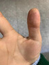脚医生手足脱皮抑菌膏汗疱湿手烂止痒疹治起小水泡去脚痒皲裂 实拍图