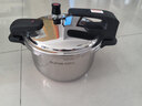 苏泊尔（SUPOR）高压锅可立盖304不锈钢压力锅100kpa一旋开盖5L磁炉通用22cm 实拍图