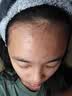 Colongon青少年爽肤水保湿精华水补水杏仁酸水杨酸控油祛痘收毛孔去闭口 实拍图