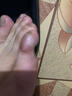 脚医生鸡眼贴12贴鸡眼膏成人去脚根足部肉刺脚趾老茧脚垫脱落 实拍图