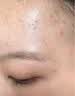 [纽兰]葡萄糖酸锌口服溶液 10ml:35mg*10支 3盒装 成年人祛痘消炎重度面部痤疮专用内服药青少年硬疙瘩祛痘口服液葡萄糖酸锌女士 痤疮内服药 实拍图