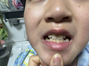 奥乐V6-12岁洁白系列小孩学生儿童护牙剂 换牙期虫牙牙黄黑斑 儿童牙膏 【专业洁白】50克6支装，送4件礼 实拍图