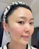 艾薇岚械字号水光滚针原液打自艾薇岚水光童颜眼周三型胶原蛋白黄金盒 艾薇岚面部胶原 5ml单支 带防伪 实拍图