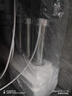 奥克斯（AUX）净水器家用直饮厨房超滤净水机大流量不锈钢自来水过滤器无废水免插电商用净饮机国家补贴 自行安装【智显-富锶超滤+前置】 实拍图