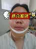 Livex面雕线雕提拉紧致瘦脸绷带下颌套腮腺术后头套抽脂术后修复面罩 实拍图