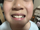 奥乐V6-12岁洁白系列小孩学生儿童护牙剂 换牙期虫牙牙黄黑斑 儿童牙膏 【专业洁白】50克6支装，送4件礼 实拍图