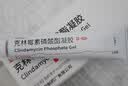 达林克林霉素磷酸酯脂凝胶10g/盒 寻常痤疮红肿痘熬夜痘青春痘闭口粉刺黑头毛囊炎暗疮脓疱疮祛痘 实拍图