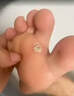 [信龙]水杨酸软膏 5%*20g 1盒装 鸡眼膏去i根肉刺药膏无痛脱落连根拔非贴成人去刺猴跖疣老茧脚鸡眼去除特新效期药去疣 水杨酸软膏软化角质去鸡眼 实拍图