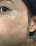 EDRI熊果苷乳膏去斑去黑色素祛斑美白淡斑提亮去黄改善暗沉肤色医美用 实拍图