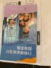 SIGMA希格玛308白癜风治疗仪银屑病光疗家用纳米紫外线医用同源 35强度308光疗仪30X30mm充电SQ1DJG 实拍图