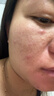 资生堂悦薇全能水乳（清爽）250ml套装抗初老第二代男女母亲节礼物 实拍图