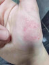 HIH凡士林手足干裂脚裂膏脚后跟干裂起硬皮足跟开裂防干裂皲裂护手霜 实拍图