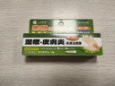 日本进口三井药品皮炎湿疹膏皮肤瘙痒痱子斑疹真菌感染止痒全身可用不含激素药膏15g京东自营 实拍图