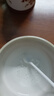 皓牛补牙树脂材料自己在家补牙齿神器牙呀洞栋填充剂高硬度医用正品 实拍图