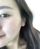 ASTACURE医用去痣点痣膏祛痣膏専用药脸部不留疤激光笔药水官方正品男女士 实拍图