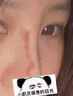 DR.MICKEY医用重组生长因子凝胶牛碱性成纤维细胞点痣喷人表皮祛疤痕膏修复 实拍图