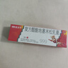 三九医药 999皮炎平 复方醋酸地塞米松乳膏20g/支 止痒药膏 神经性皮炎 接触性皮炎 脂溢性皮炎 湿疹  实拍图