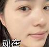 透真377美白祛斑淡化黑色素雀斑抗皱紧致淡纹面部玫瑰精华油去黄次抛 实拍图