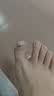 脚医生甲沟炎矫正器神指甲长肉里嵌甲纠正专用正甲贴片 实拍图