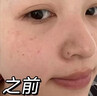 透真377美白祛斑淡化黑色素雀斑抗皱紧致淡纹面部玫瑰精华油去黄次抛 实拍图