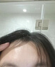 维特丝水杨酸祛痘膏祛痘印淡痘印壬二酸15%凝胶胶态硫烟酰胺乳膏青春期 实拍图