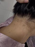 KOOGIS祛痘喷雾背粒消祛痘膏水杨酸后背前胸长痘毛囊淡化痘印修复黑色素 实拍图