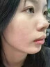 [纽兰]葡萄糖酸锌口服溶液 10ml:35mg*10支 3盒装 成年人祛痘消炎重度面部痤疮专用内服药青少年硬疙瘩祛痘口服液葡萄糖酸锌女士 痤疮内服药 实拍图