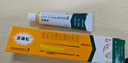 【原研好药】派瑞松 曲安奈德益康唑乳膏软膏15g正品皮炎湿疹过敏止痒水泡脚气 手足癣体癣股癣花斑癣 甲沟炎 实拍图