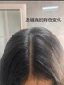 维特丝防脱洗发水生姜固发侧柏叶育控油去屑洗头膏露男女士专用金榜第1 实拍图