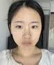 EDRI熊果苷乳膏去斑去黑色素祛斑美白淡斑提亮去黄改善暗沉肤色医美用 实拍图