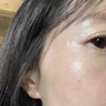 东洋之花熊果苷乳膏去斑霜黑色素祛斑美白淡斑提亮去黄改善暗沉肤色医美用 实拍图