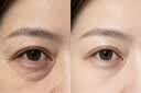 白云山美白抗皱眼霜紧致抗老40岁以上淡化细纹眼袋黑眼圈国货眼霜一名 实拍图
