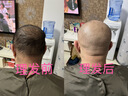奥克斯（AUX）理发电推子剃头理发神器自己剪电动剃须刀光头神器男士全家通用成人儿童鬓角修剪器全套礼物 实拍图