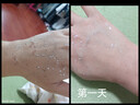【华邦制药 迪维】维A酸乳膏0.025%*15g/盒【效期至27年1月】 实拍图