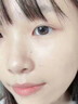 医用精华液械字号收缩毛孔粗大修复细致去黑头粉刺闭口男士女士祛痘印黑色素沉淀控油淡化痘印痘坑透明质酸钠 实拍图