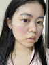 沃朗森医用面膜械字号冷敷贴医美术后补水修复祛痘印消炎透明质酸钠礼盒 实拍图
