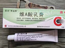 维A酸乳膏去疣体特新效期药扁平疣专用药去疣类药膏去脖子小肉粒颈部瘊子去尤瘊小肉粒去疣膏瘊子肉刺肉粒 1盒装【国药准字脱疣瘊】 瘊子去除国药准字药膏  放心购买 安心售后 实拍图