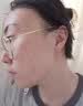 藤石制药激光点痣后脸部去红印黑印凹陷修复凝胶祛痣疤痕膏淡化红印色素DS 单盒装 实拍图