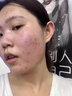 DR.MICKEY医用重组生长因子凝胶牛碱性成纤维细胞点痣喷人表皮祛疤痕膏修复 实拍图