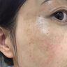 东洋之花熊果苷乳膏去斑霜黑色素祛斑美白淡斑提亮去黄改善暗沉肤色医美用 实拍图