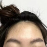 OHBT壬二酸15%凝胶水杨酸祛痘药膏祛痘淡化痘印坑消炎痤疮专用青少年 实拍图
