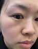 井次制药去痣点痣膏水无痕脸部痦子扁平疣瘊子面部黑痣男女士通用 实拍图