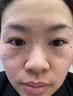 井次制药去痣点痣膏水无痕脸部痦子扁平疣瘊子面部黑痣男女士通用 实拍图