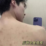 尊蓝除螨沐浴露男女士专用500g祛痘控油止痒持久留香氛沐浴保湿润肤 实拍图