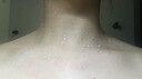 维A酸乳膏去疣体特新效期药扁平疣专用药去疣类药膏去脖子小肉粒颈部瘊子去尤瘊小肉粒去疣膏瘊子肉刺肉粒 1盒装【国药准字脱疣瘊】 瘊子去除国药准字药膏  放心购买 安心售后 实拍图