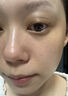 妮雅丝益生菌水乳套装控油祛痘护肤品油敏感肌青少年补水保湿学生礼物 【升级款2件套】水+乳 实拍图