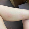 涩冈制薬日本青草膏蚊虫叮咬止痒消肿防蚊子儿童神器户外驱蚊清凉晕车提神 实拍图